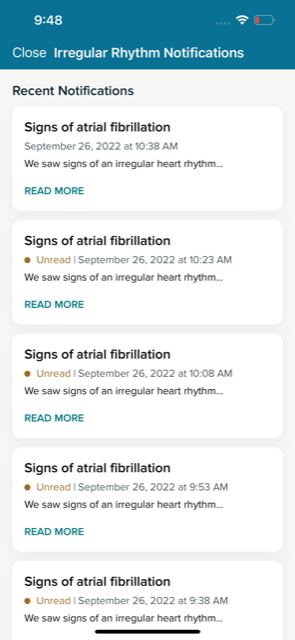 How Fitbit Irregular Rhythm check for atrial fibrillation (AFib)?